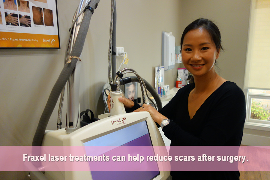 xeomin Fraxel Laser scar minimisation