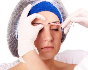 time for a blepharoplasty? best age for eyelid surgery