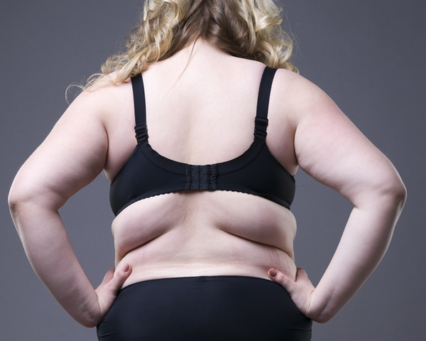 breast-reduction-lipo Melbourne -back-fat-liposuction.